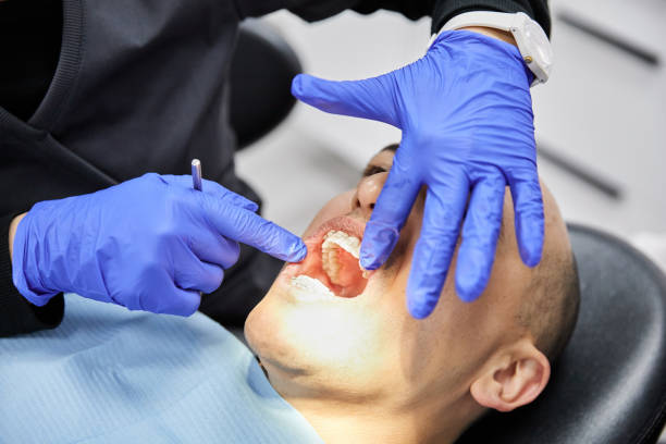 Best Emergency Dental Care for Broken or Chipped Teeth in South Russell, OH